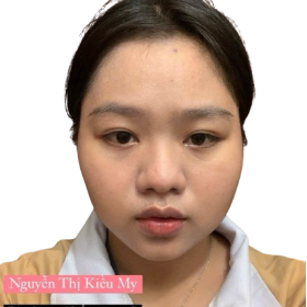 Nguyễn Thị Kiều My