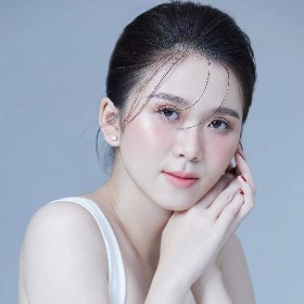 TRƯƠNG THỊ YẾN NHI