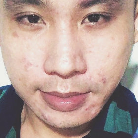 Huỳnh Quốc Nguyên